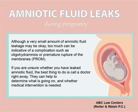 how to tell if leaking amniotic fluid|Amniotic Fluid: What is It and Signs of Leaking